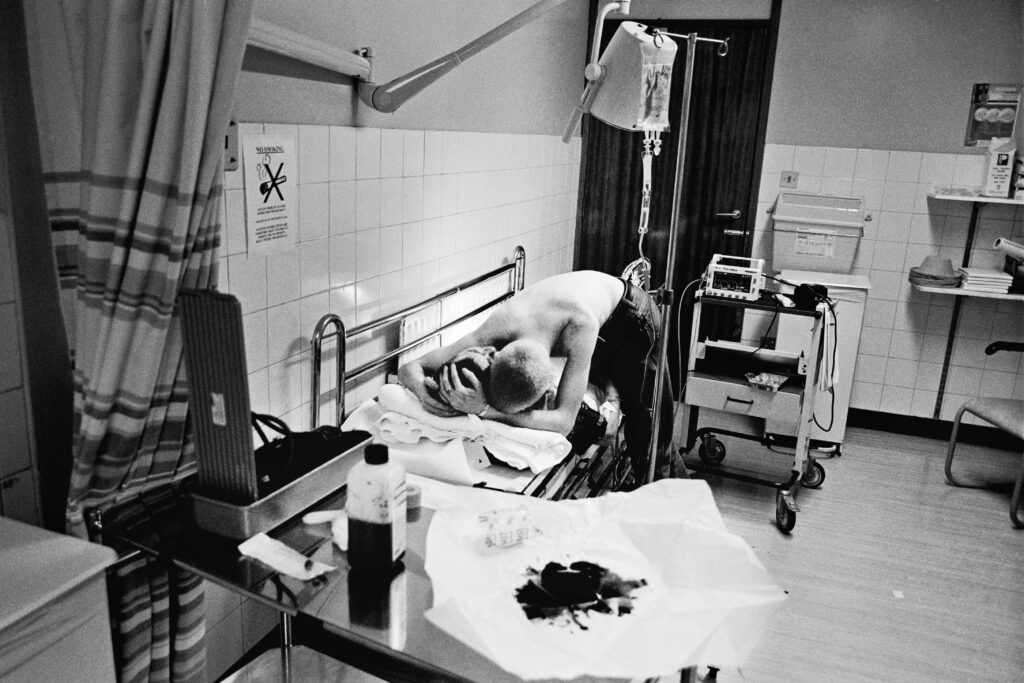 A man is comforted by his friend on his bed in A&E following a brutal machete attack that severed his hand. Glasgow Scotland