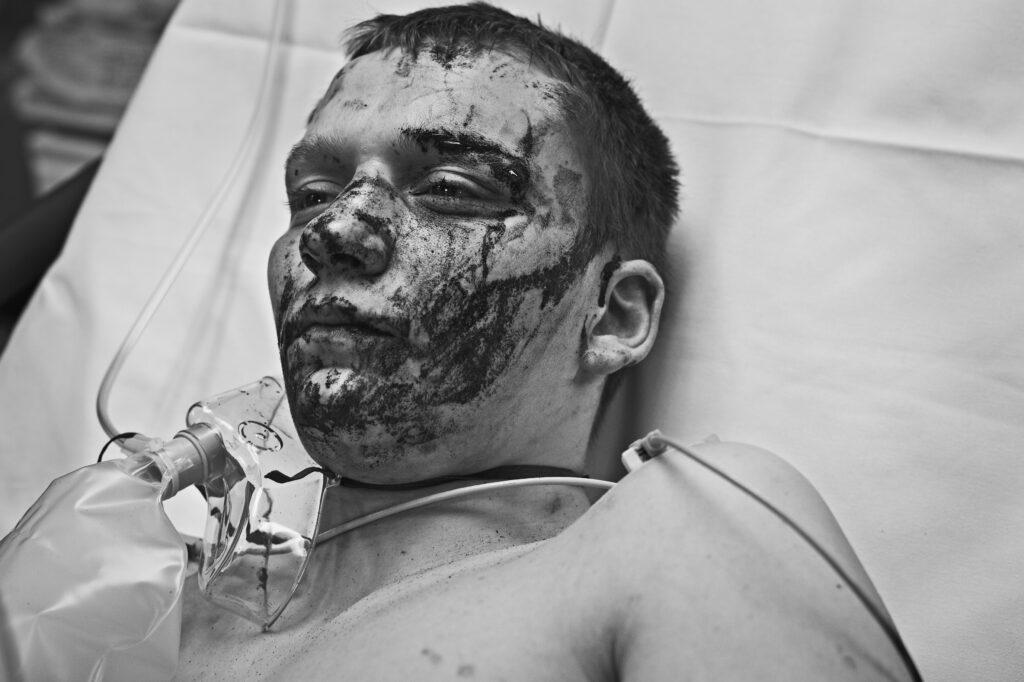 A young man with horrific with facial injuries following a knife attack receives oxygen in A&E, Glasgow