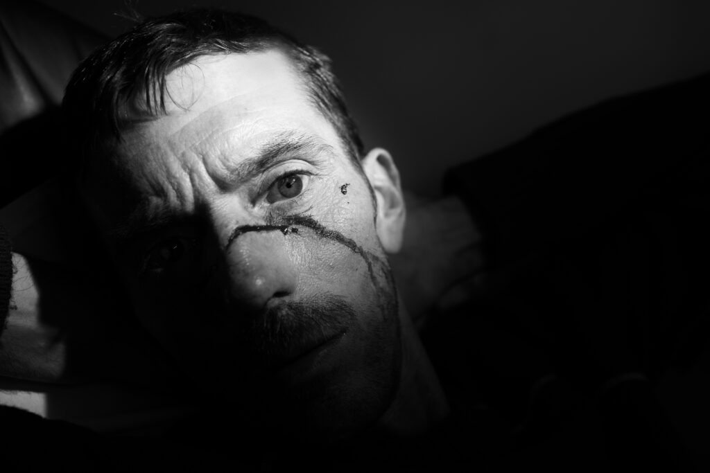 A man who was hit in the face with a hatchet attends A&E in Glasgow Scotland
