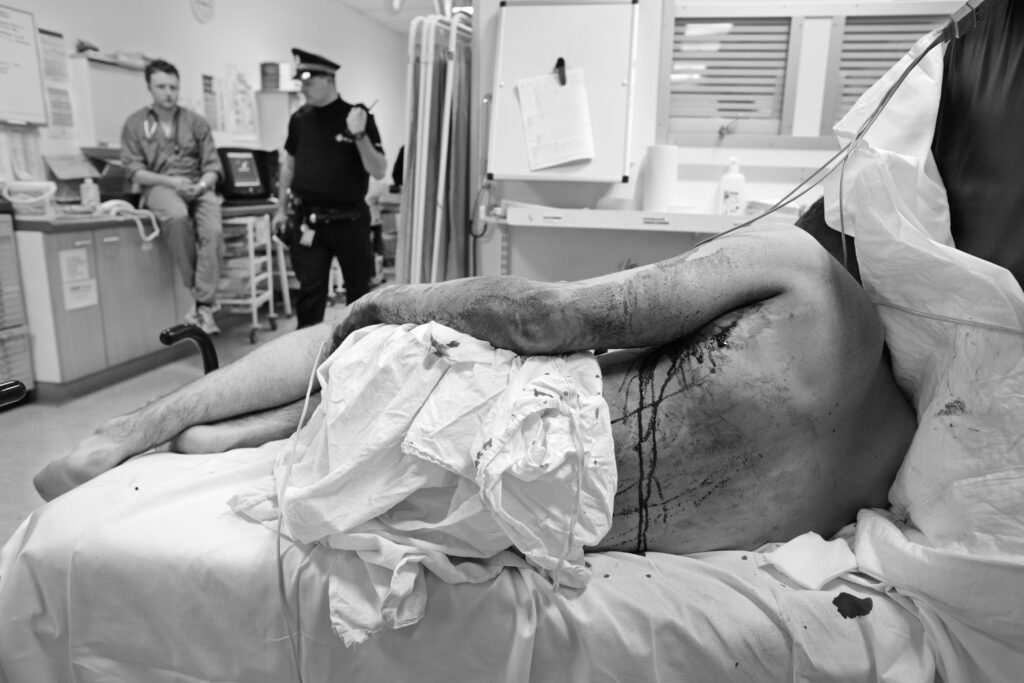 A young man stabbed several times in a fight in a nightclub attends A&E in Glasgow Scotland